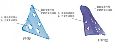 青光眼引流器的市场概况