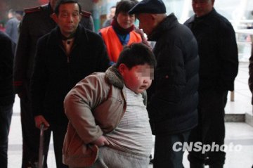男孩不足10岁体重200余斤遭父母遗弃