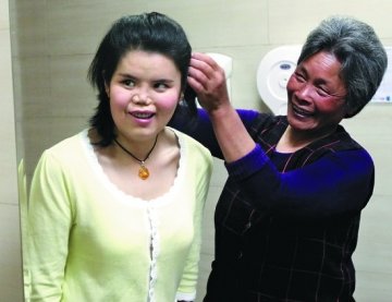 22岁女子脸部先天畸形 近十次手术后成功换面孔