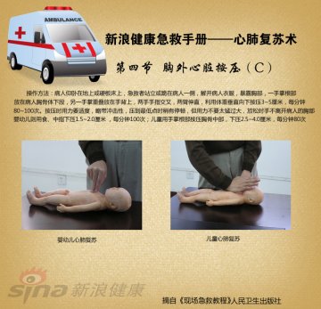 心肺复苏术12-胸外心脏按压(C)