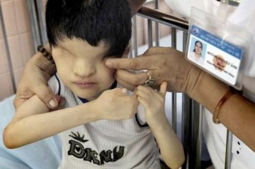 越战遗毒二噁英：80克毒剂可使80万人死亡