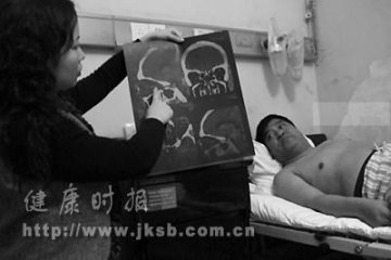 福寿螺事件患者仍存在不同程度的症状