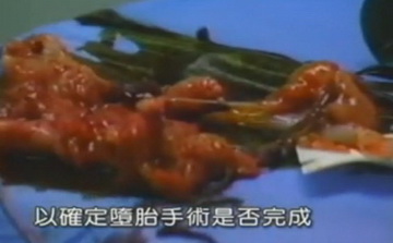 实拍少女人流全过程