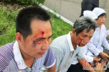 东莞康华医院保安“群殴”病人家属 被媒体曝光