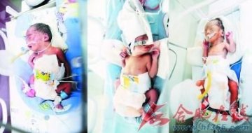 3胞胎患病需巨额医药费 家长称可能忍痛放弃1个