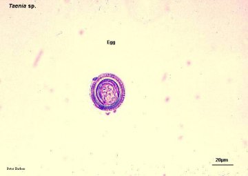 猪带绦虫虫卵