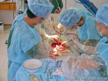 女性很伟大！惊心动魄剖腹产全程