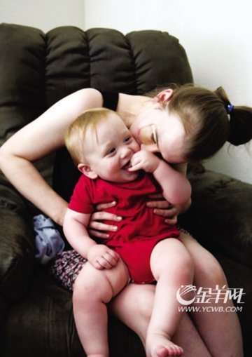 毁容妈妈为儿子制造“笑脸”