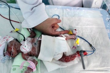 一体重不足950克男婴降生保定二中心医院