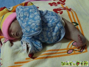 湖南小人鱼紧急抢救50分钟无效夭折