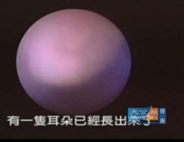 实拍堕胎手术全过程 呼吁珍惜生命