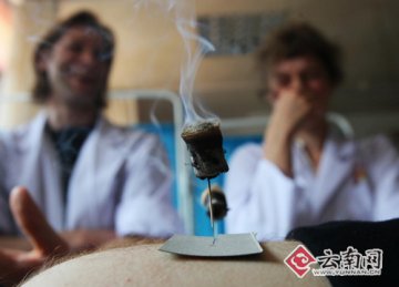 针灸在云南从未冷清过 申遗成功后也不会单独涨价