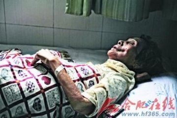 87岁老太住院后骨折 家属要求医院赔偿15万