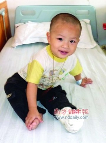 儿子先天长短脚贫父欲卖房求医 治愈率不到30%