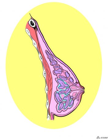 乳腺囊性增生