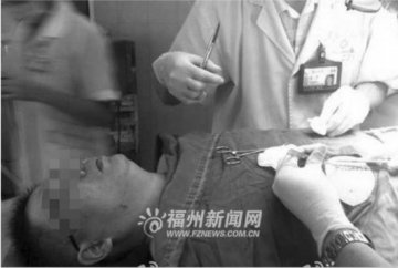 癌症未治愈 福建长乐一病人持刀砍伤医生
