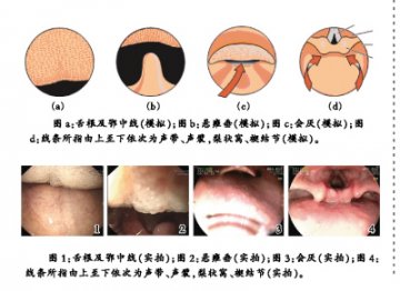 进镜：解剖结构引导方向