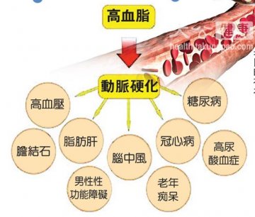 专家讲解 现代人的通病“高血脂”的中西营养两面睇