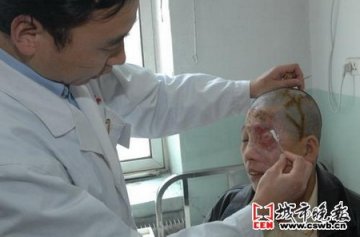 吉林实施世界首例再造眼睑和眉修复手术