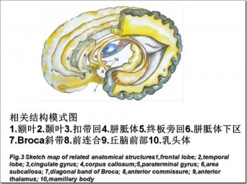 空军总医院顾建文：经胼胝体-穹隆间入路手术方法