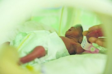 虚弱产妇生下袖珍四胞胎 取名“平安健康”