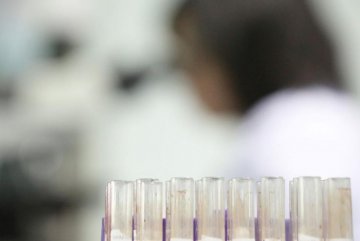 实拍精子志愿者捐献全过程