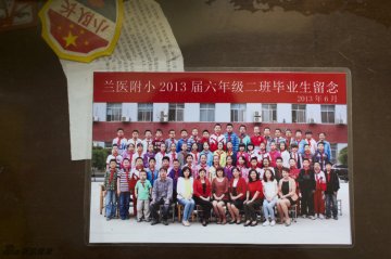 罕见病：黏多糖贮积症患者生活