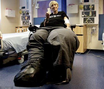 英女子患巨腿症双腿重达108kg