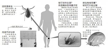 辽阳一男子疑似被蜱虫咬伤 出现发热无力症状