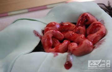 最逼真的重口味医学蛋糕