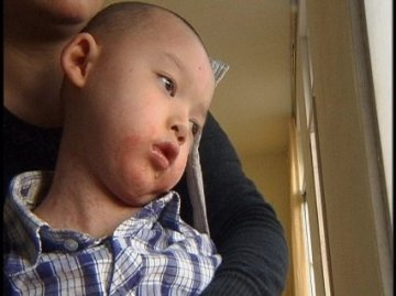 田婆婆洗灸堂继续危害幼儿
