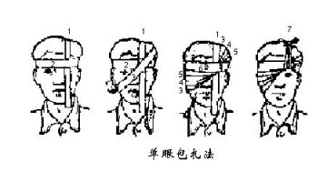 不同部位的绷带包扎步骤