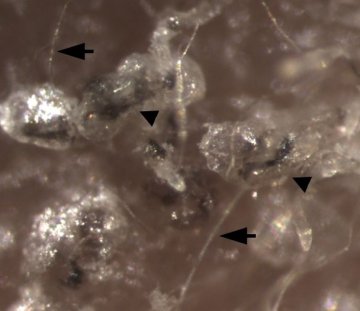 美科学家首次成功分化上皮干细胞 或可根治脱发