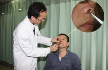 绿色疗法，治疗鼻炎