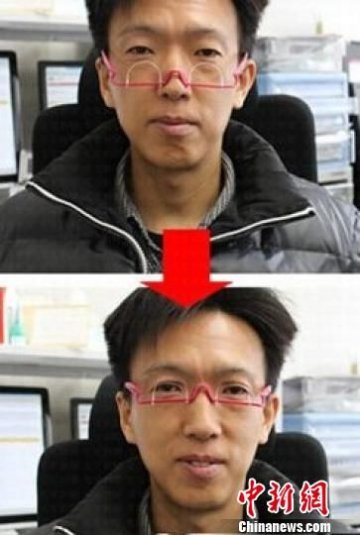 双眼皮眼镜受捧 医生称配戴不慎损伤眼皮