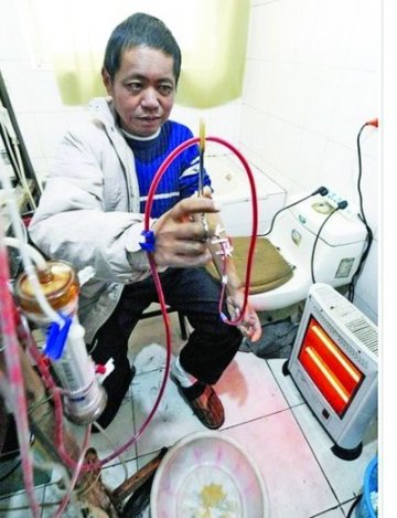 尿毒病人用厨具等自制血透机维持生命13年
