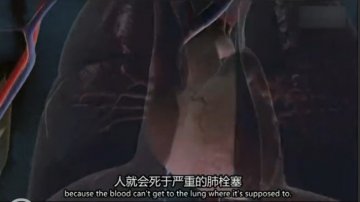 医学解读：男子腿绑香肠冒充阳物为何丧命