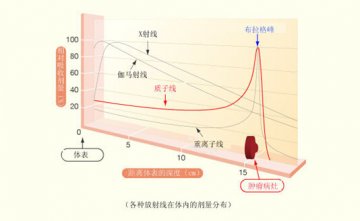 剥去华丽外衣，重离子治疗还剩下什么？