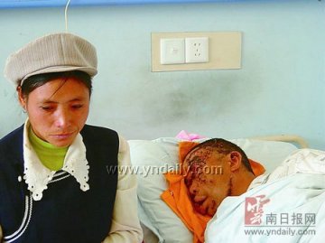 采菌人惊醒黑熊被一掌扇掉半张脸