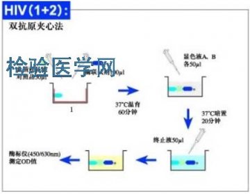 艾滋病的实验室检查