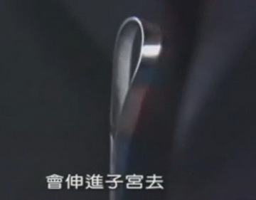 实拍少女人流全过程