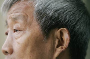 近70岁老人重新生长黑发皮肤光滑如小孩