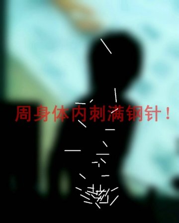 成都军区总医院挽救被残害的她