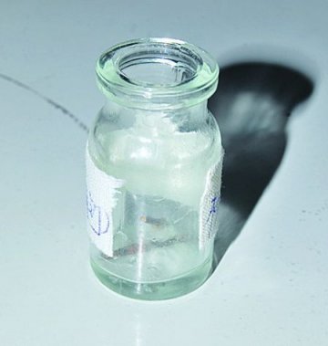 男子肾脏里存在一根4厘米铁钉达20年