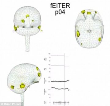 英国科学家绘制出大脑失去知觉时3D影像
