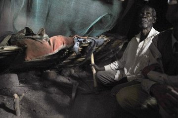 世界上最恐怖的“怪病”
