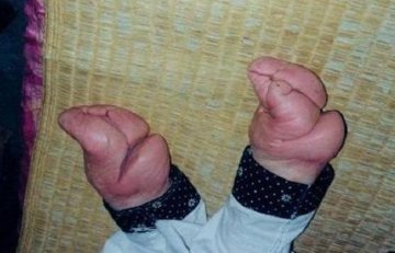 古代妇女裹足的真正原因：竟是因为性感