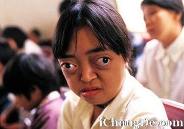 全球恐怖人体变异盘点