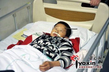 8岁小学生被筷子般粗钢筋插入左侧额头