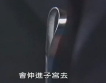 实拍：美国堕胎手术全过程